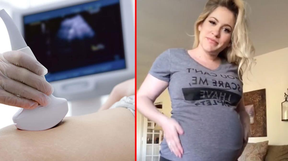 İkizlere hamile olan kadının ultrason görüntüsüne bakan doktor hayatının şaşkınlığını yaşadı